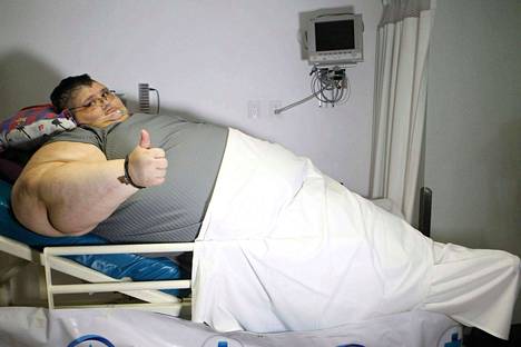 Paino hipoi 600:ta kiloa – maailman lihavin mies leikkauksessa - Maailma -  Satakunnan Kansa