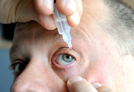 Tavallisin syy silmien kutinalle on allergia. Erityisesti siitepölyaikana allergia­potilaiden tekee mieli hangata silmiä.