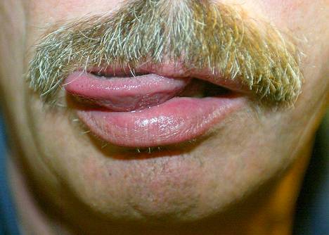 Marraskuun aikana ei kannata ihmetellä viiksiä kasvattavia. Movember-tempauksella tuetaan eturauhassyövän vastaista kamppailua.
