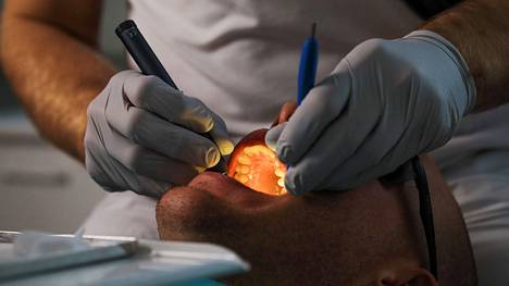 Koronaepidemian jälkeen keväällä purettiin hoitojonoja, mikä näkyi kasvuna yli puoli vuotta kiireetöntä hammaslääkärikäyntiä odottaneiden määrissä.