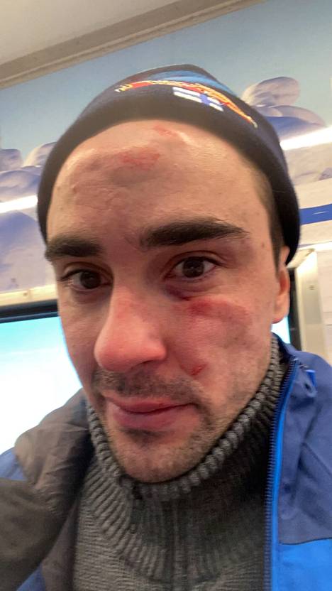 Ristomatti Hakolan kansainvälinen kilpailukausi 2021–22 sai Kuusamossa tylyn alun, kun mies kaatui maailmancupin startissa ja murjoi kasvonsa. Pekingin olympiakisojen alla ankara, hengitysteihin hiipinyt flunssa tuhosi menestysedellytykset kauden päätapahtumassa.