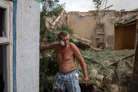 Venäjän joukkojen tekemässä iskussa poskeensa haavan saanut mies otti tukea rakennuksesta Slovjanskin kaupungissa Donetskin alueella tiistaina 5. heinäkuuta. Kaupungin pormestarin mukaan Slovjansk joutui tulituksen kohteeksi myös torstaina. 
