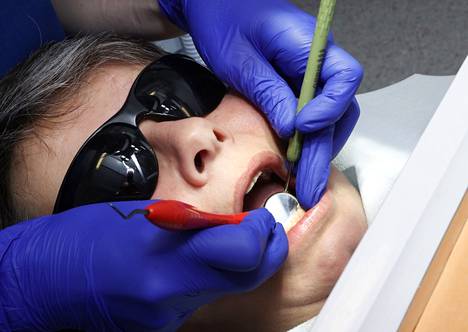 Jatkossa hammaskiven poiston tulee perustua hammaslääkärin diagnoosiin.