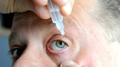 Normaalisti silmänvalkuainen on valkoinen. Ajoittainen silmien punoitus tai kutina ovat yleensä ohimeneviä oireita, mutta joskus ne voivat vaatia lääkärin hoitoa.