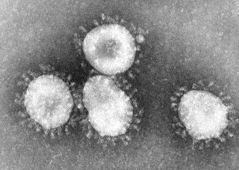 Mikroskoopissa koronavirus näyttää tältä. Virusryhmä on saanut nimensä auringon koronaa muistuttavasta muodostaan.