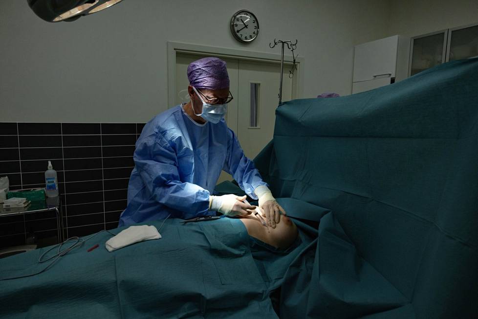 Plastiikkakirurgi Janne Jyränki tekee viillon Vilman rinnan alle. 